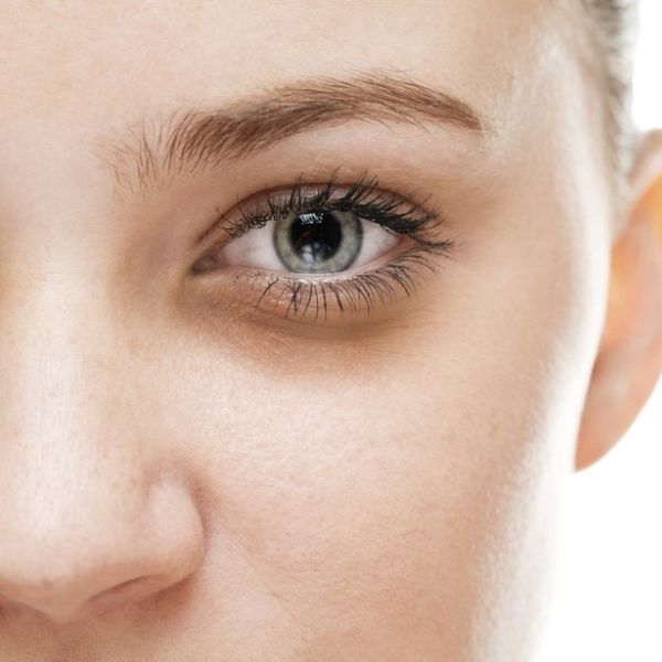 Quầng thâm dưới mắt là bệnh gì? Cảnh báo 4 bệnh lý có thể gặp