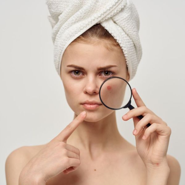 Quy trình skincare cho da mụn sạch mịn với 8 bước đơn giản